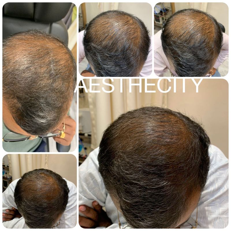 Hair treatment results