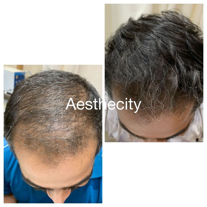 Hair treatment results